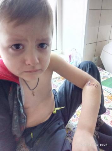 Собака, обитающая на территории гаражного кооператива, покусала ребенка