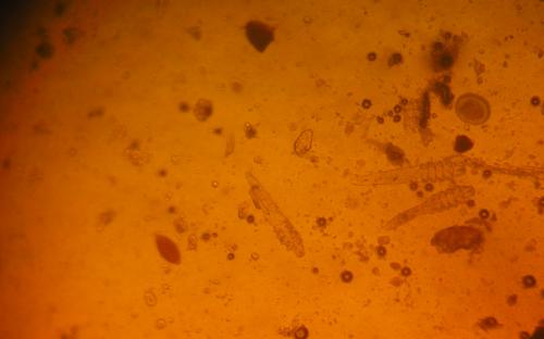 ПАРАЗИТОЗИ БЕЗПРИТУЛЬНИХ СОБАК