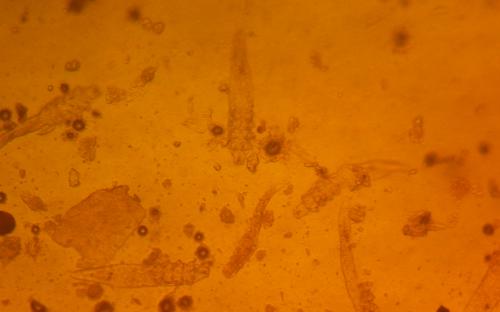 ПАРАЗИТОЗИ БЕЗПРИТУЛЬНИХ СОБАК