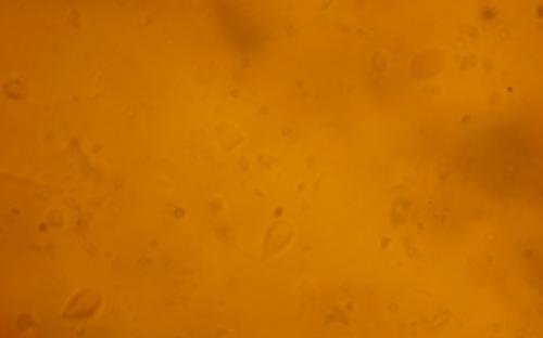 ПАРАЗИТОЗИ БЕЗПРИТУЛЬНИХ СОБАК