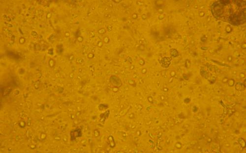 ПАРАЗИТОЗИ БЕЗПРИТУЛЬНИХ СОБАК