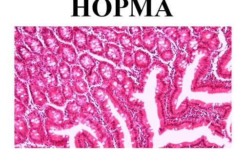 Предотвращение заражения дипилидиозом человека