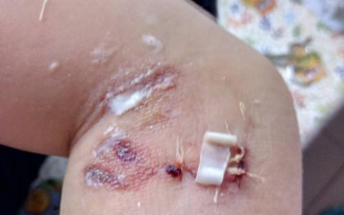 Собака, обитающая на территории гаражного кооператива, покусала ребенка