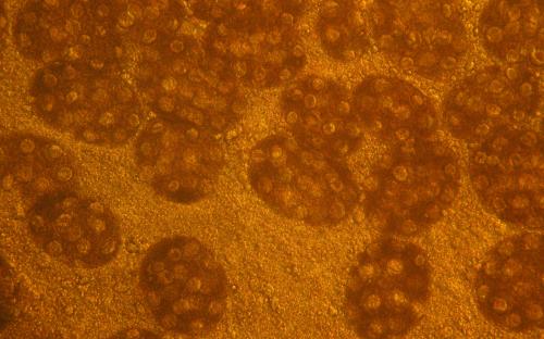 Предотвращение заражения дипилидиозом человека